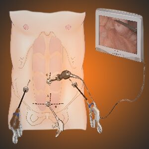 Colorectal Reconstructive Surgery