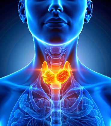 Invasive Lobular Carcinoma (ILC)