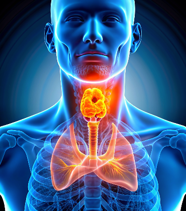 Invasive Lobular Carcinoma (ILC)